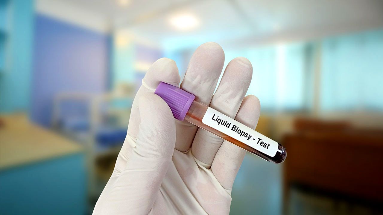 Strengthen Preventive Healthcare With Reliable DNA Based Cancer Screening